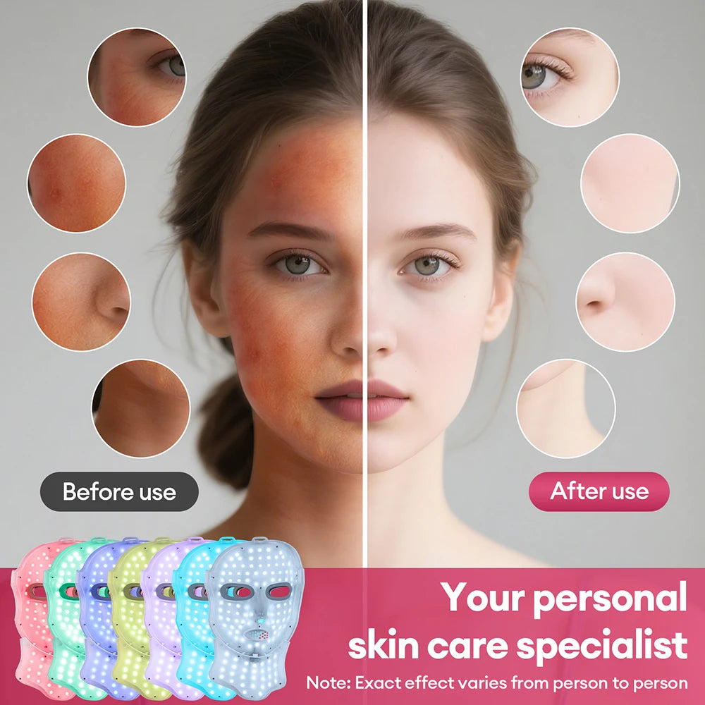 Wireless 7-Color LED Face & Neck Mask Rechargeable Photon Therapy Device